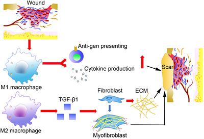 Direct and Indirect Roles of Macrophages in Hypertrophic Scar Formation